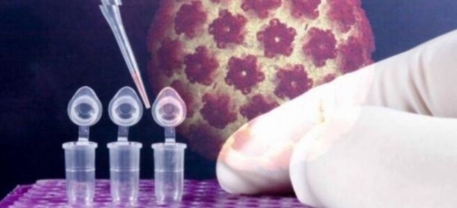 Mga diagnostic ng HPV gamit ang digene test